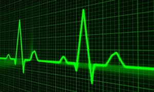 Pulse trace 163708 1280 1 1000x600.jpg