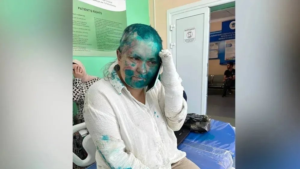 230704131839 01 elena milashina attack e1688511194179.webp.jpeg