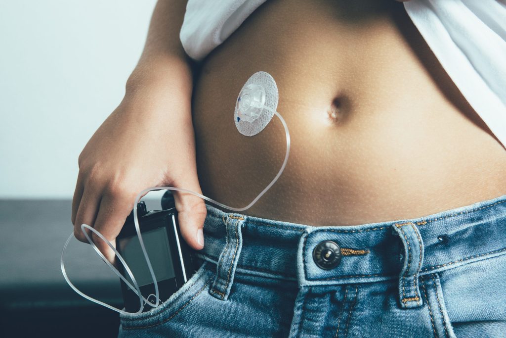 Plano de saúde deve cobrir bomba de insulina para paciente com diabetes, decide STJ